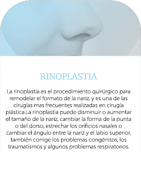 rinoplastia_